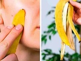 Ne jetez plus les peaux de bananes à la poubelle : voici 8 astuces intelligentes pour les réutiliser