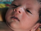 Allergie alimentaire chez le bébé : symptômes clés et conseils pour une réaction appropriée
