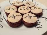Cupcakes ecg