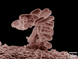 E. coli et les compulsions alimentaires